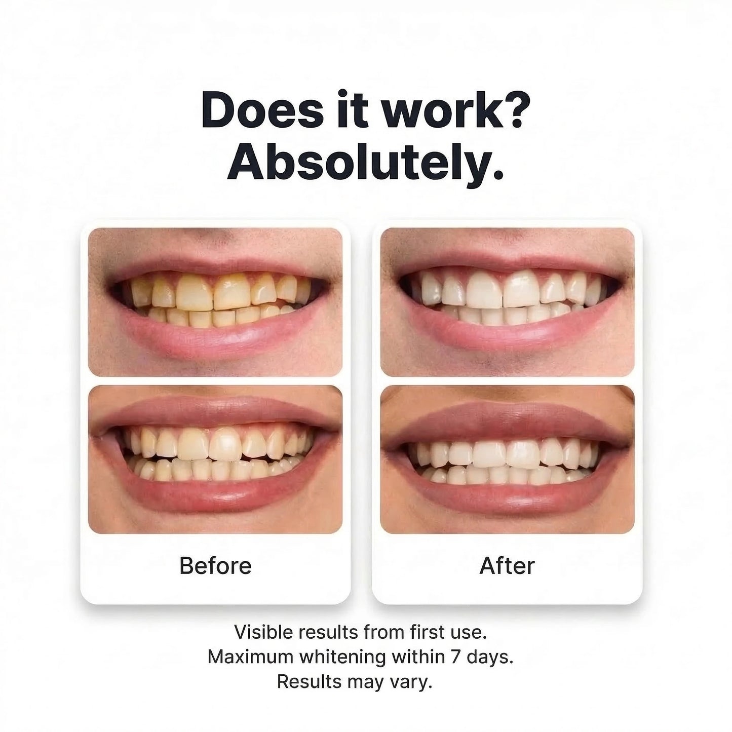 VIV™ Purple Whitening Strips